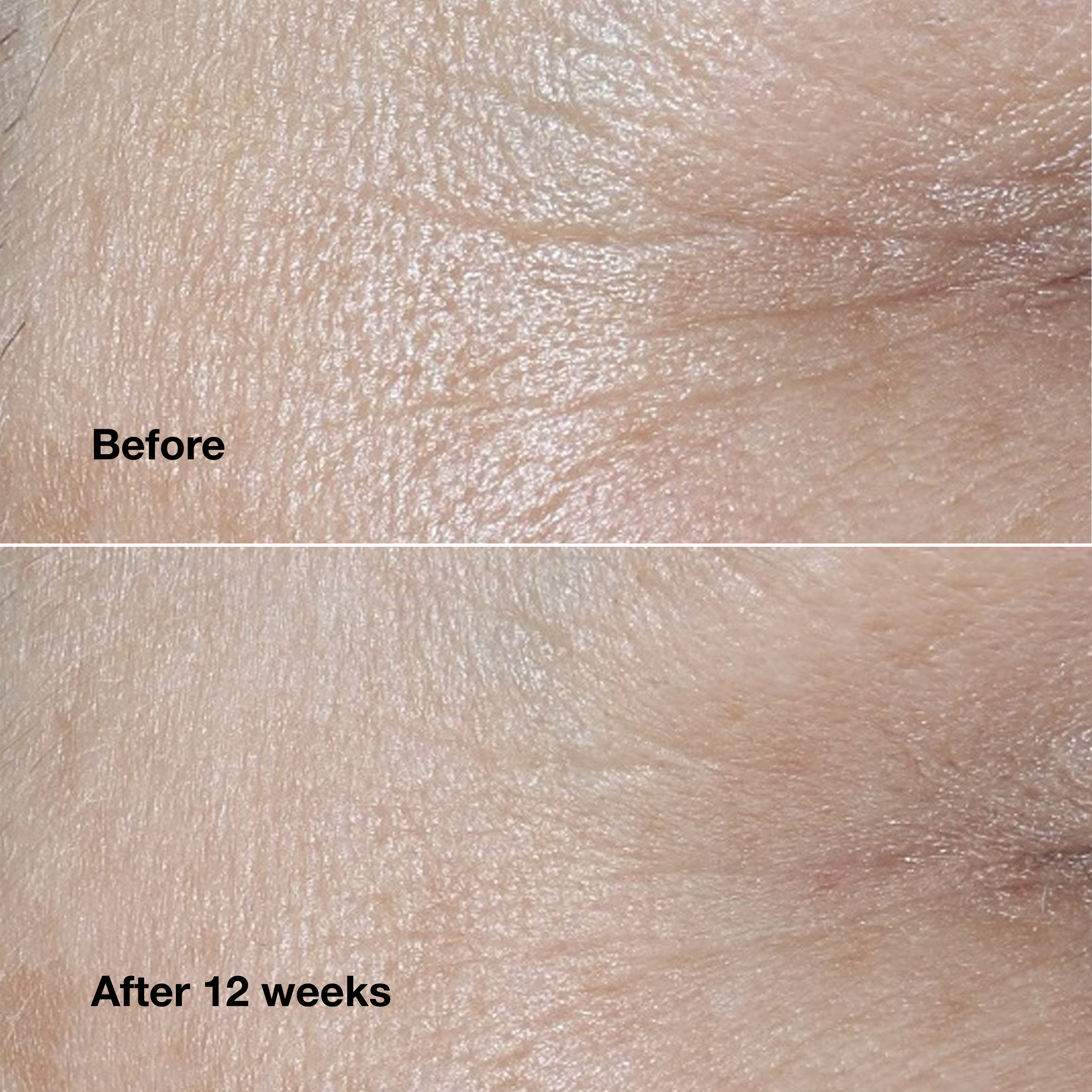 Clinique Smart Clinical Repair™ Wrinkle Correcting Cream | Clinique