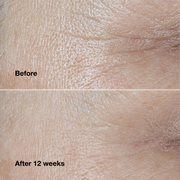 Clinique Smart Clinical Repair™ Wrinkle Correcting Cream
