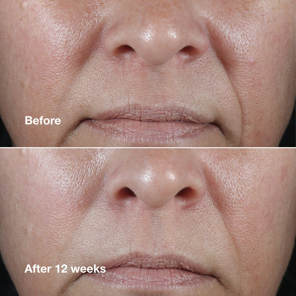 Clinique Smart Clinical Repair™ Wrinkle Correcting Rich Cream
