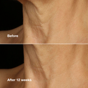 Clinique Smart Clinical Repair™ Lifting Face + Neck Cream