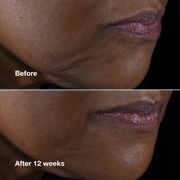 Clinique Smart Clinical Repair™ Lifting Face + Neck Cream