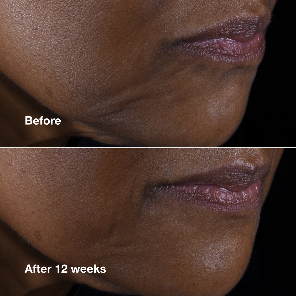 Clinique Smart Clinical Repair™ Lifting Face + Neck Cream