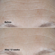 Clinique Smart Clinical Repair™ Broad Spectrum SPF 30 Wrinkle Correcting Cream