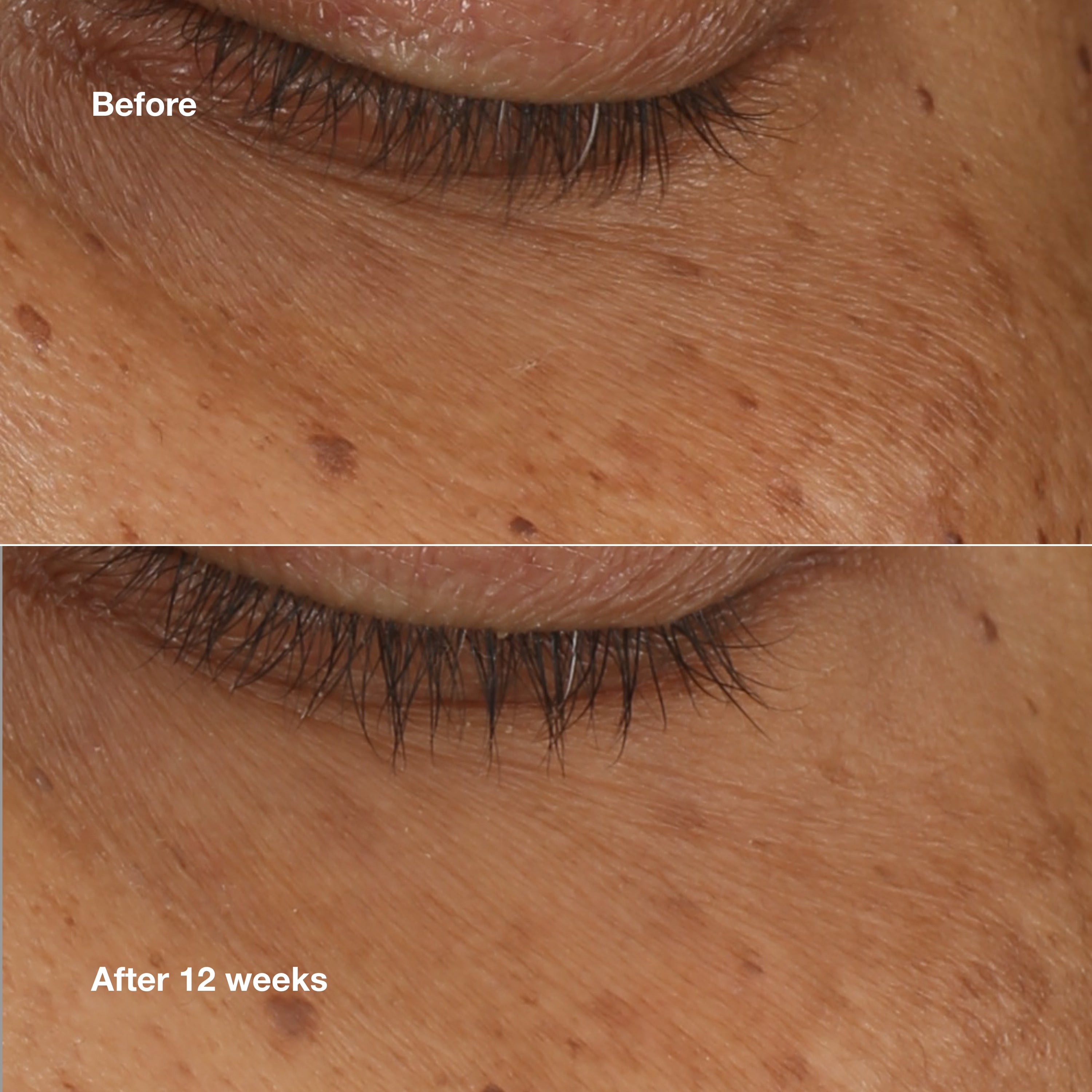 All About Eyes™ Brightening Eye Serum Concentrate | Clinique