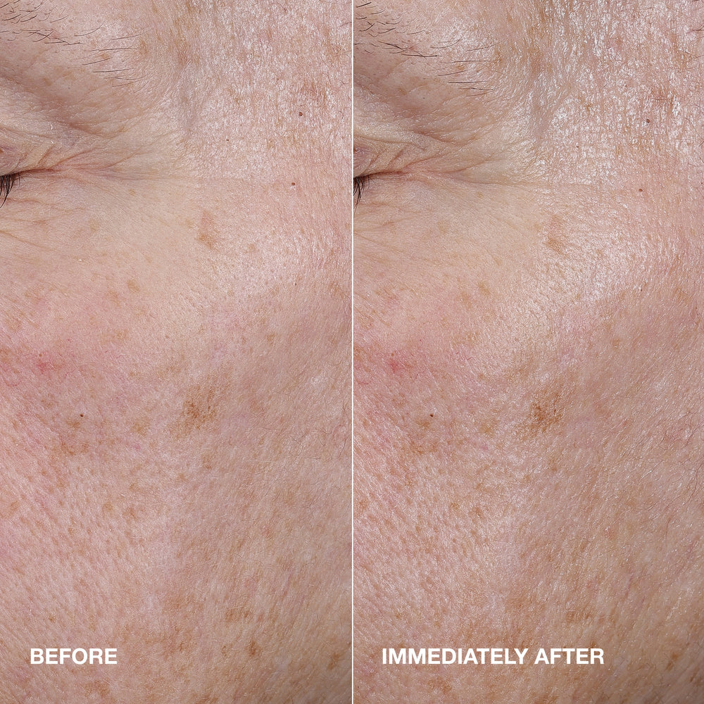 Moisture Surge™ Active Glow Serum