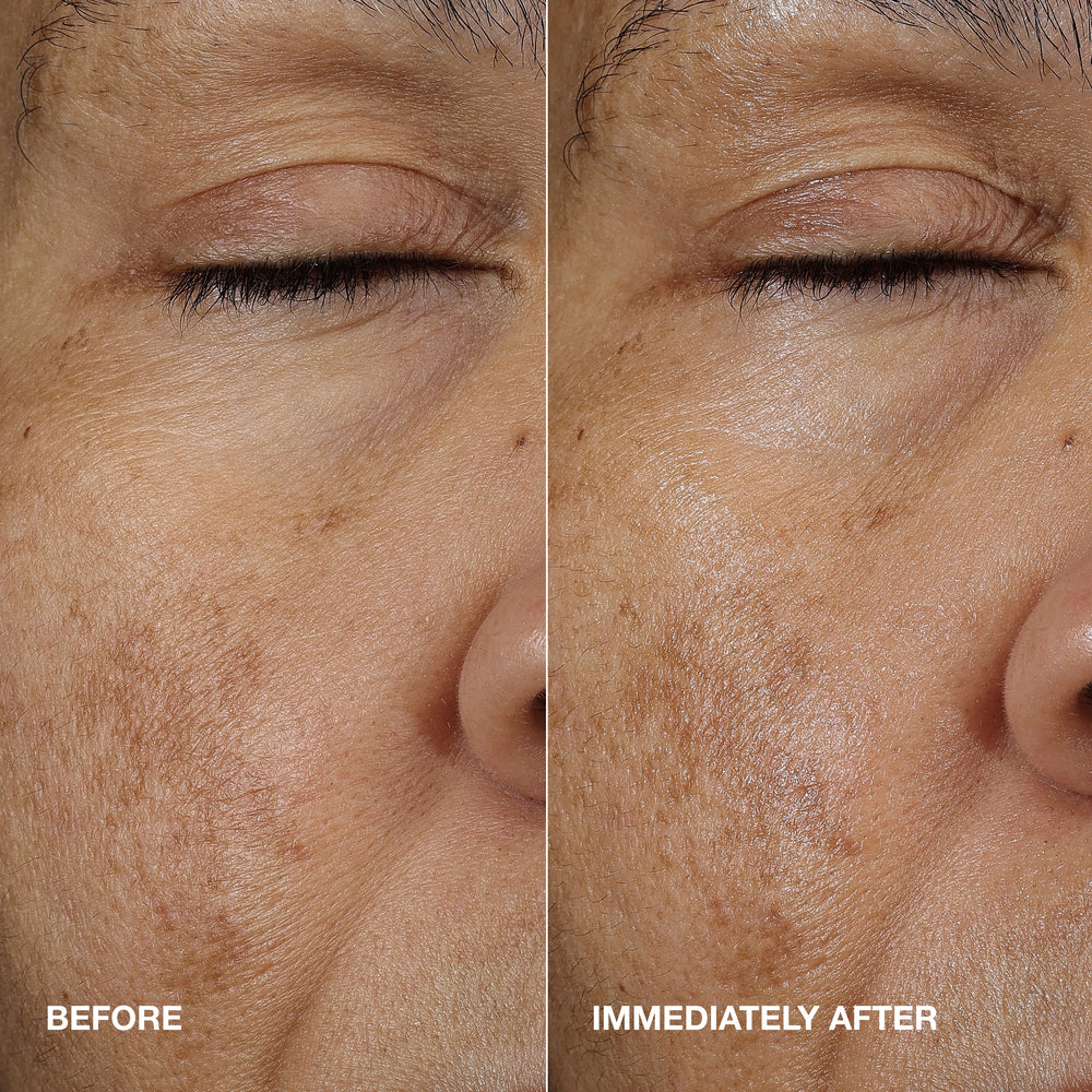 Moisture Surge™ Active Glow Serum