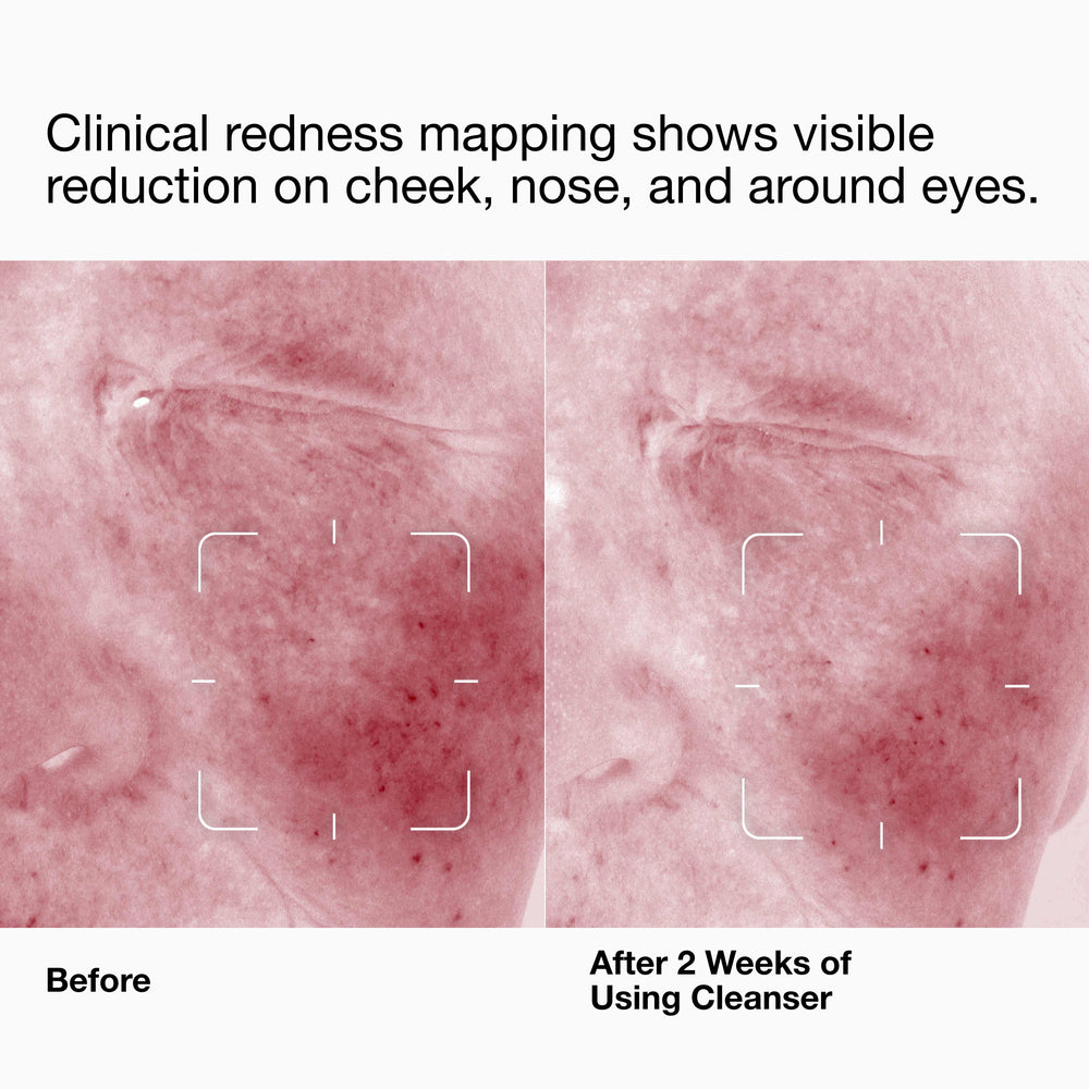 Clinique Daily Calm™ Gentle Cream Cleanser