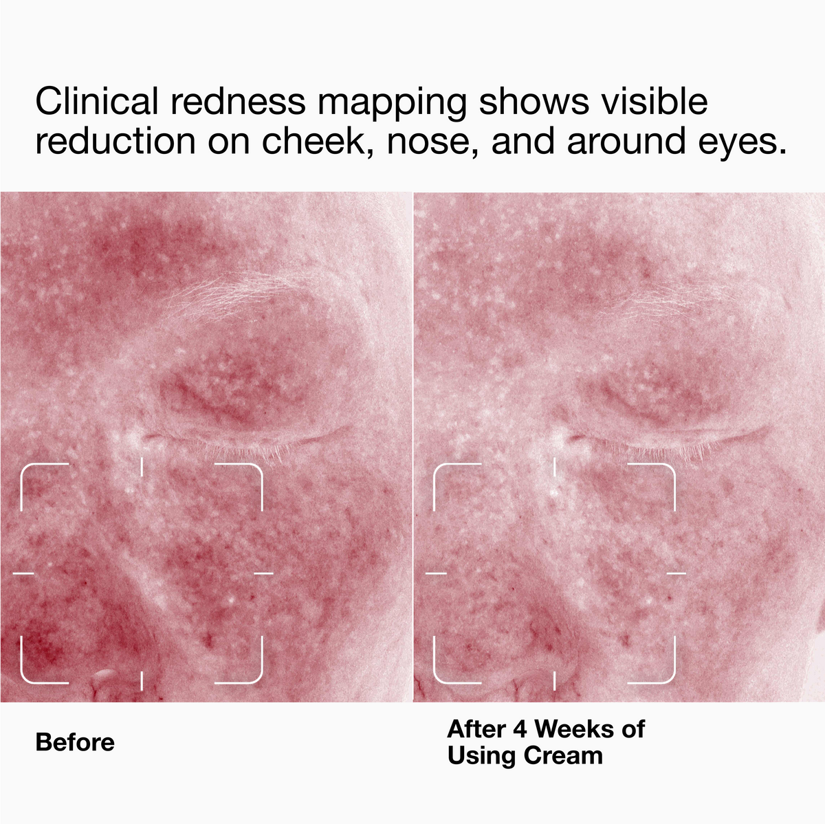 Clinique Daily Calm™ Soothing Repair Cream