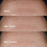 Clinique Smart Clinical Repair™ Wrinkle Correcting Serum