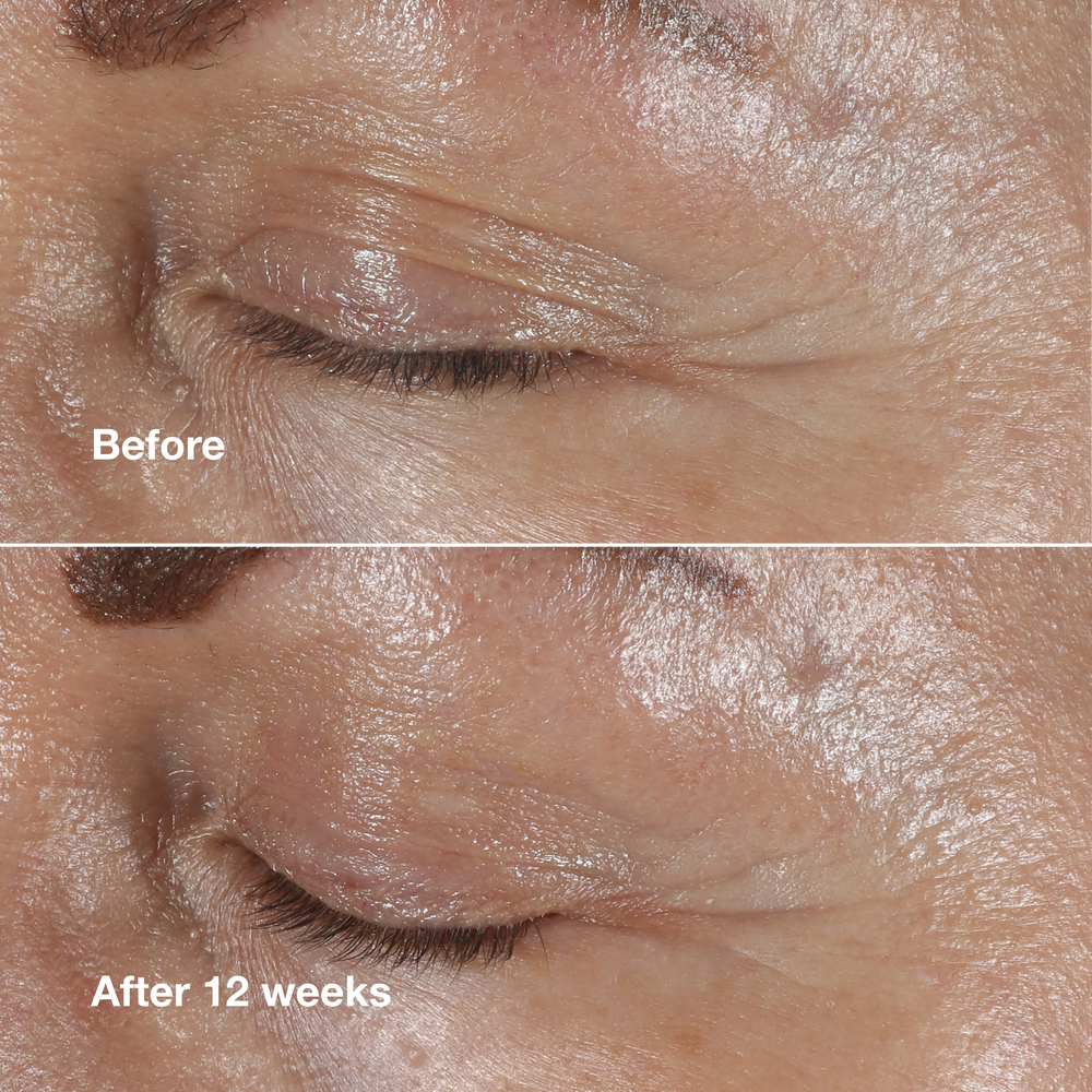 Clinique Smart Clinical Repair™ Wrinkle Correcting Eye Cream