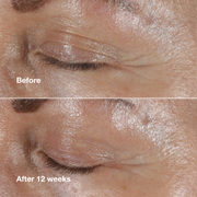 Clinique Smart Clinical Repair™ Wrinkle Correcting Eye Cream