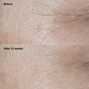 Clinique Smart Clinical Repair™ Broad Spectrum SPF 30 Wrinkle Correcting Cream