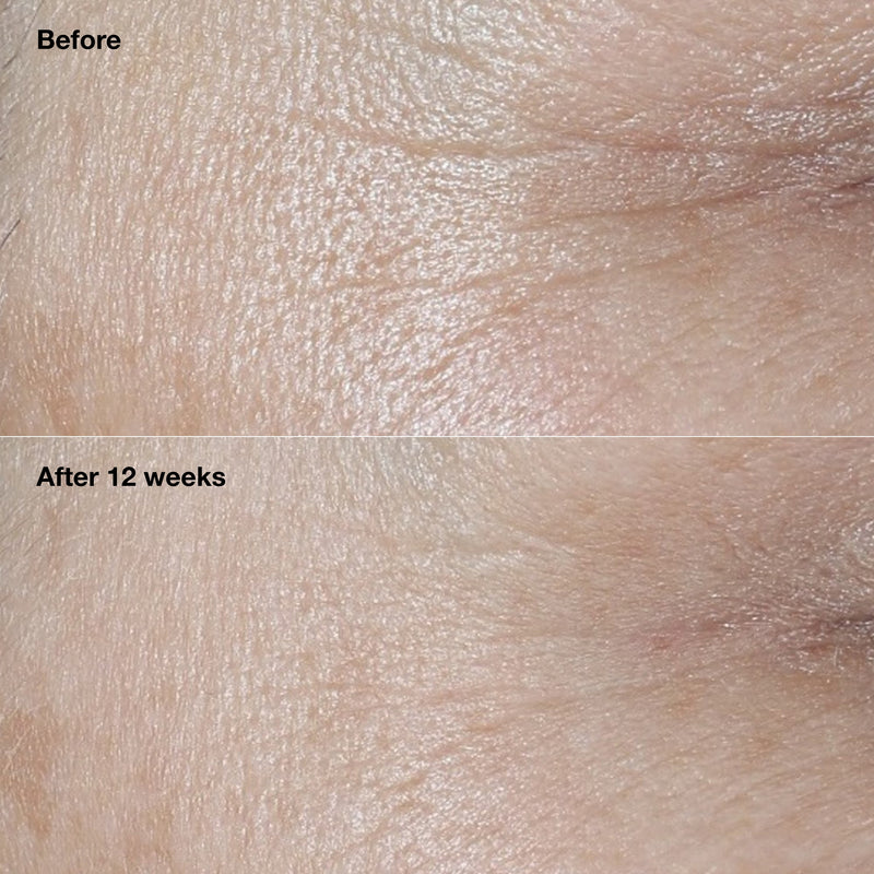 Clinique Smart Clinical Repair™ Broad Spectrum SPF 30 Wrinkle Correcting Cream
