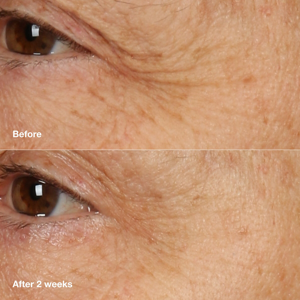 Clinique Smart Clinical Repair™ Overnight Recovery Cream + Mask