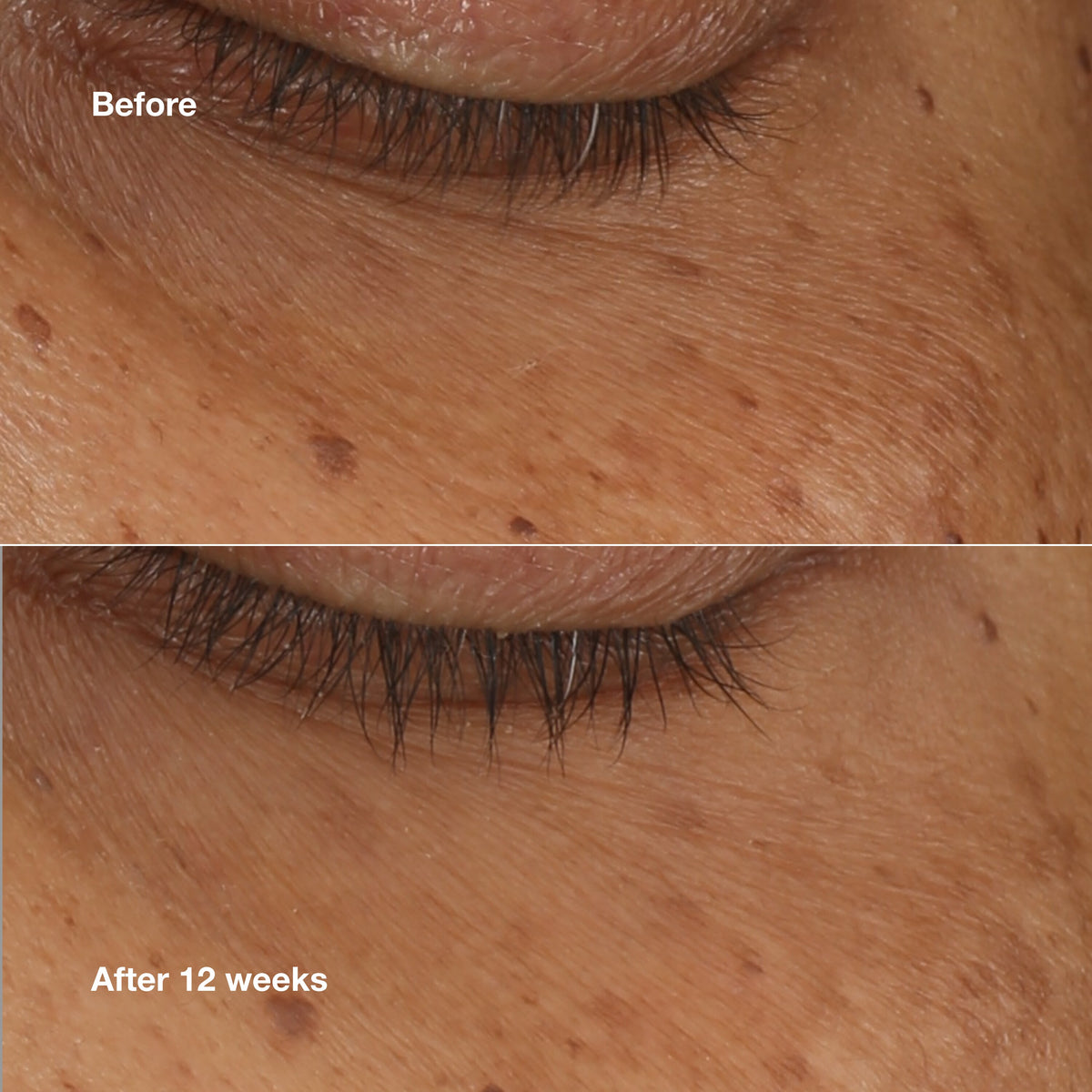 All About Eyes™ Brightening Serum Concentrate