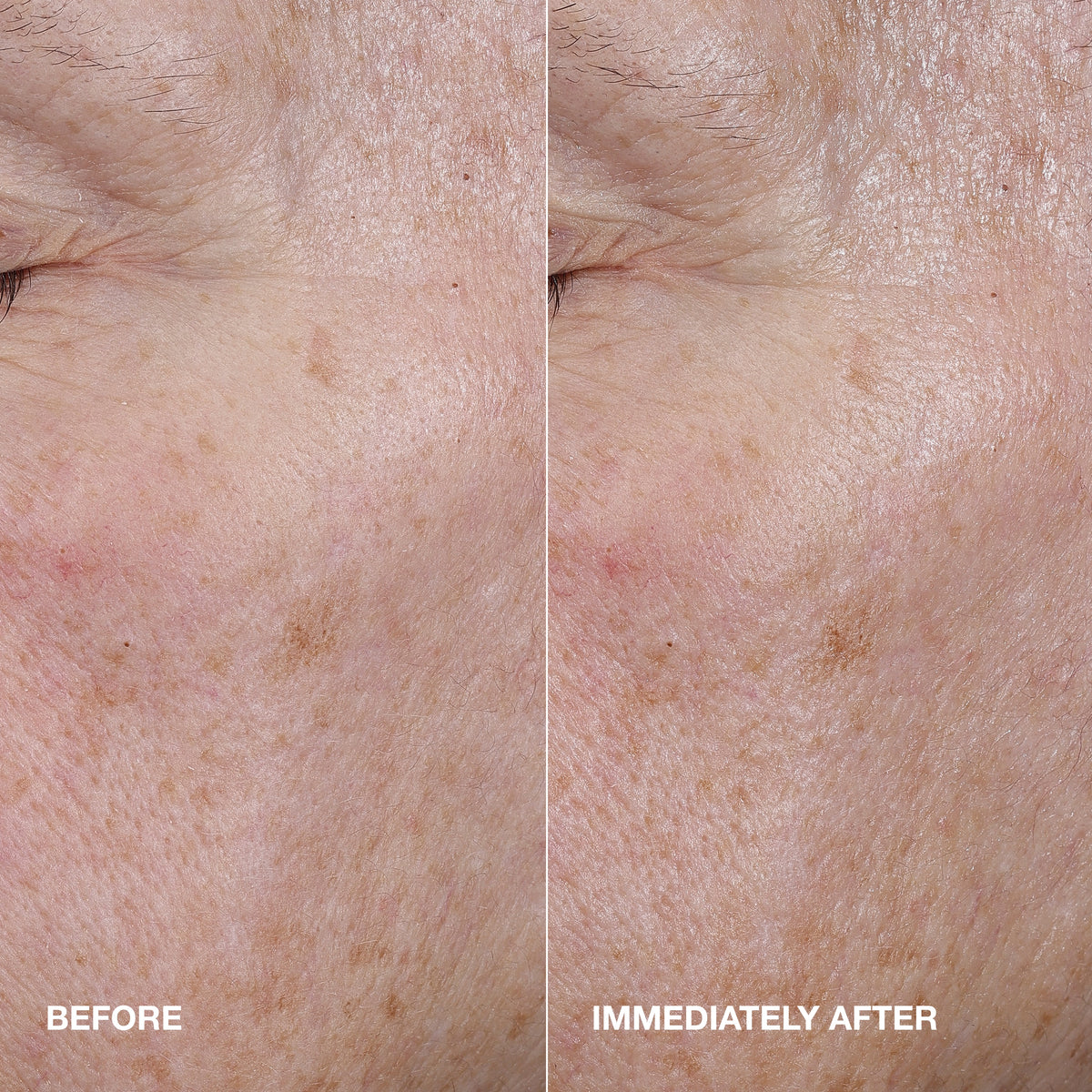 Moisture Surge™ Active Glow Serum