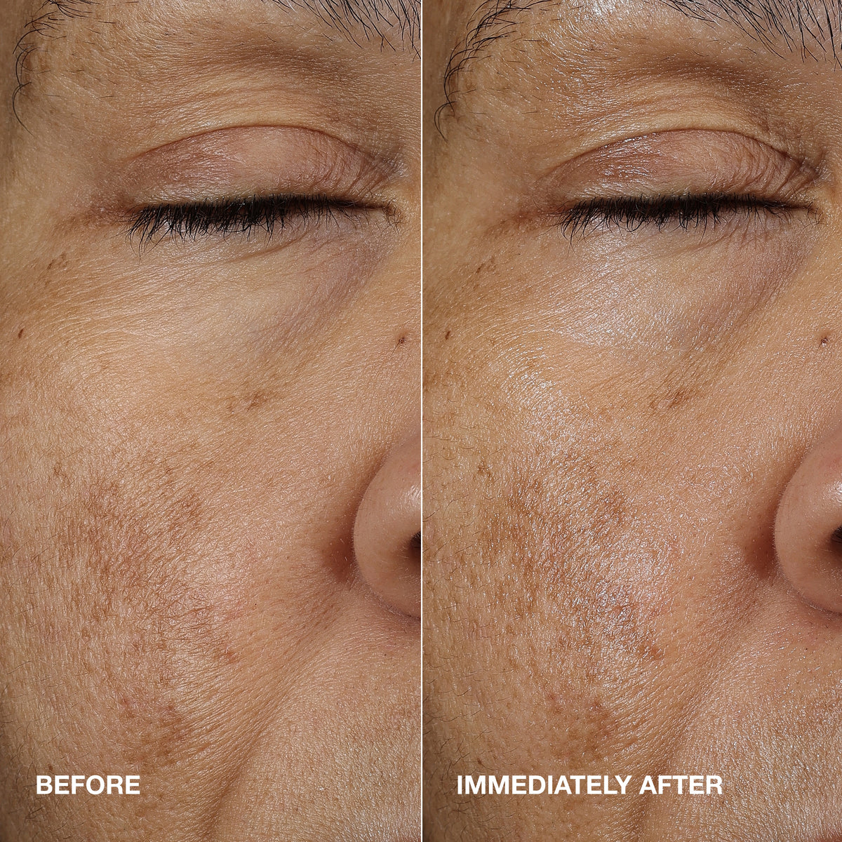Moisture Surge™ Active Glow Serum