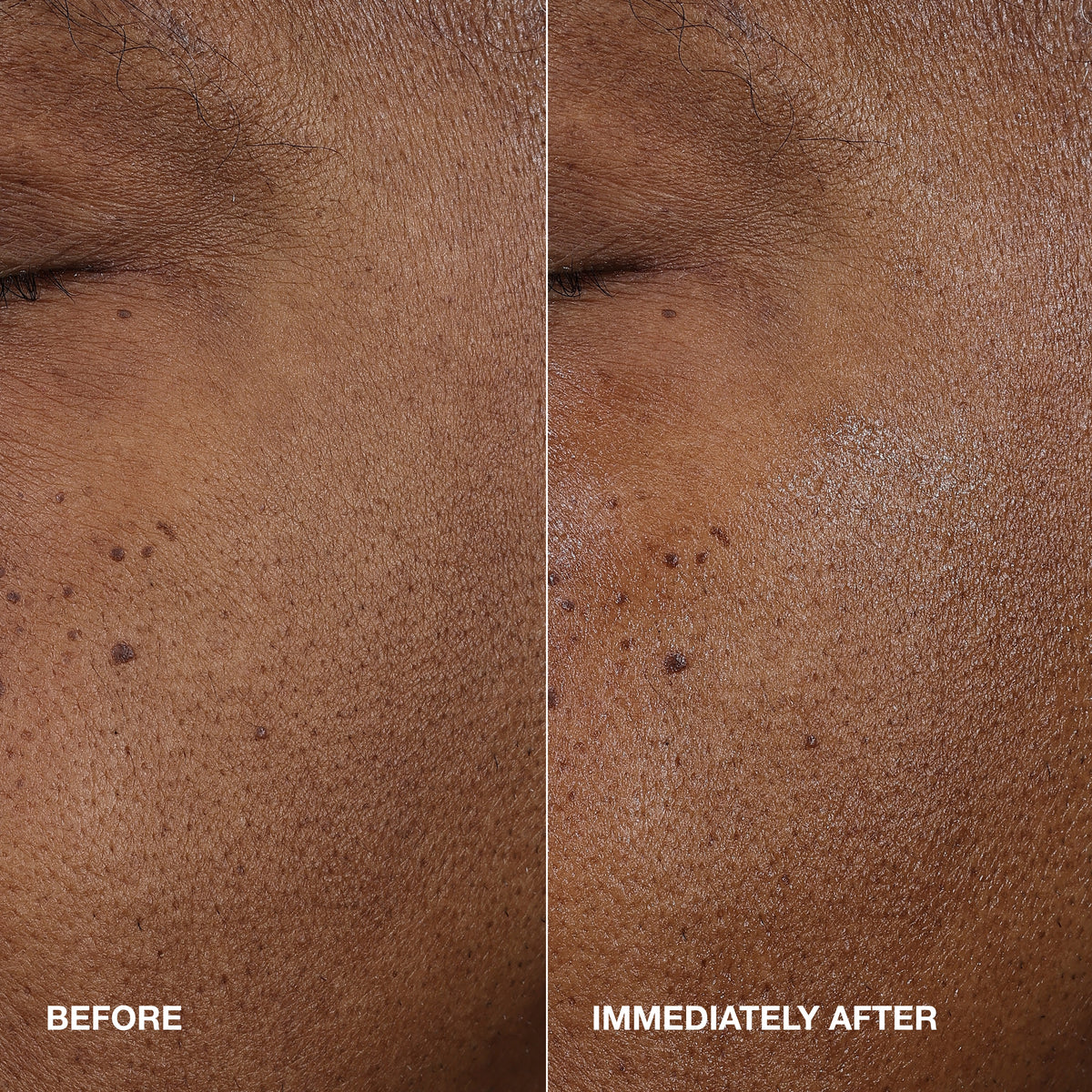 Moisture Surge™ Active Glow Serum