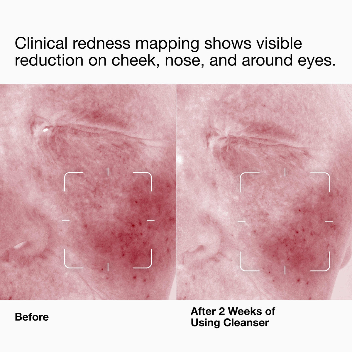 Clinique Daily Calm™ Gentle Cream Cleanser