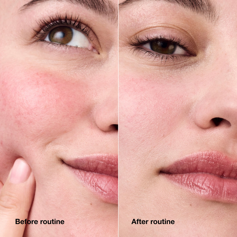 Redness Solutions Daily Relief Cream