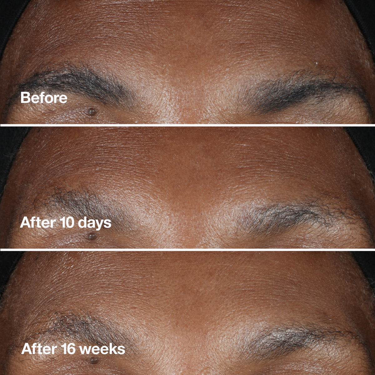 Clinique Smart Clinical Repair™ Wrinkle Correcting Serum