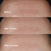 Clinique Smart Clinical Repair™ Wrinkle Correcting Serum