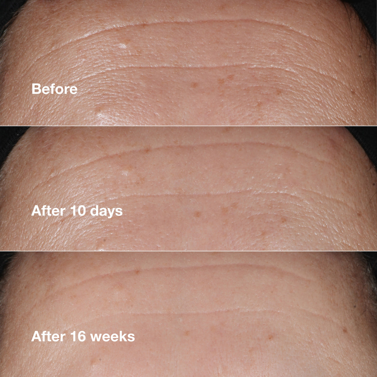 Clinique Smart Clinical Repair™ Wrinkle Correcting Serum