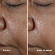 Clinique Smart Clinical Repair™ Wrinkle Correcting Serum