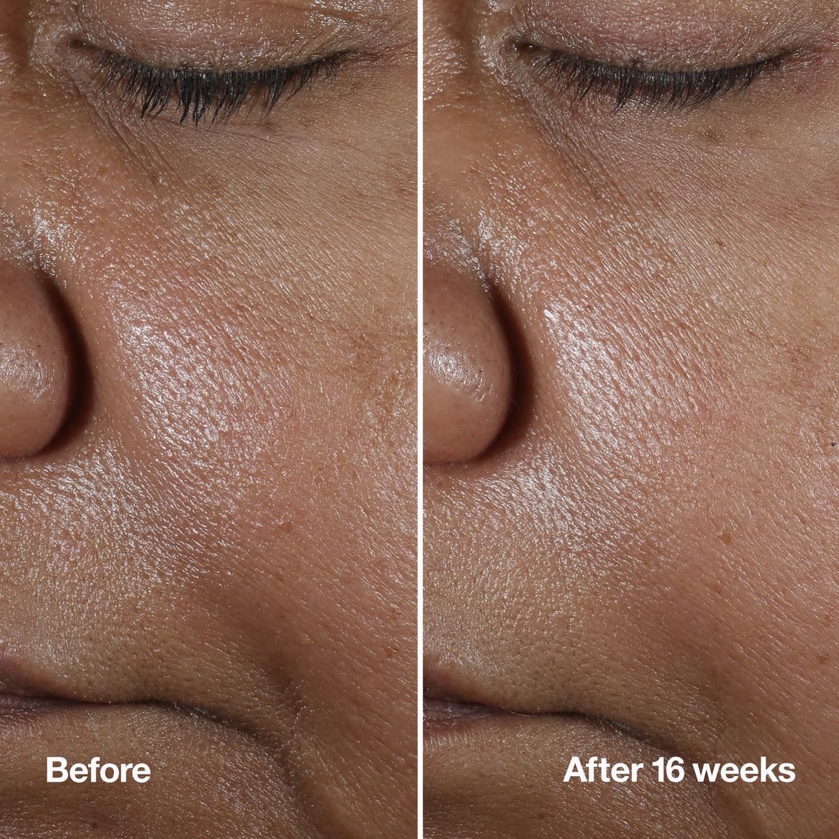 Clinique Smart Clinical Repair™ Wrinkle Correcting Serum