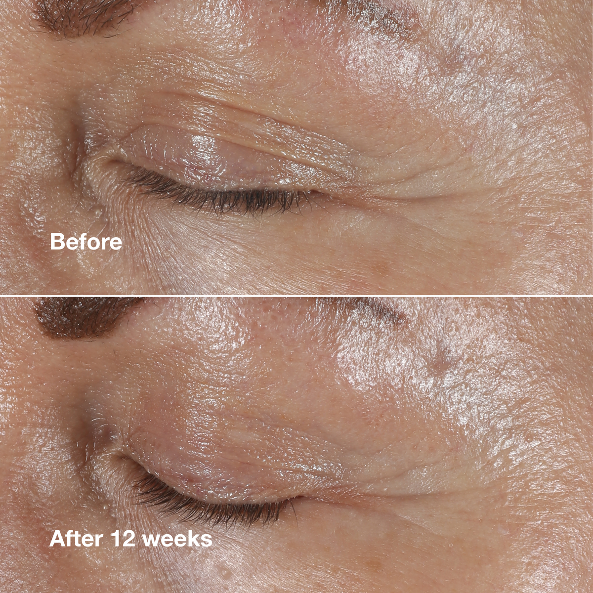 Clinique Smart Clinical Repair™ Wrinkle Correcting Eye Cream